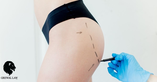 Doctor preparing woman for plastic surgery.